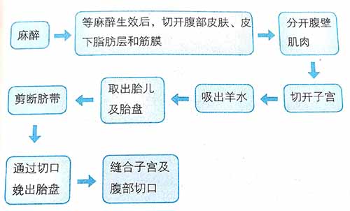 剖宫产产前须知及手术过程